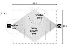 Diagram showing overlapping areas labeled "tinnitus area" and "nerve activity area" with two points marked as P1 and P2. The diagram includes measurements, with dashed lines indicating different distances: 20 feet at the top, 15 feet on the right, and a scale of 0.5 inches equaling 1 foot at the bottom left. The areas are represented with dotted circles within a large shaded polygon.
