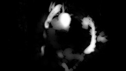 Abstract black and white image with blurry shapes, similar to smoke or ink dispersing in liquid, that resembles the curvature of a human figure in a dynamic pose, extending movements into gesture calligraphy.
